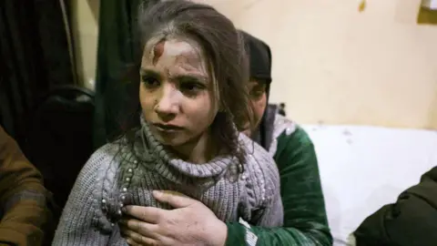 Getty Images A young girl with an injured head, covered in dust.