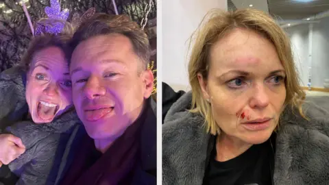 Louise Brown A woman with short blonde hair and a man with short brown hair are smiling with their tongues out while on the City Star Flyer. She is wearing an antler headband. In the second photo, on the right, she is pictured with cuts and bruises.