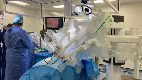 OLIVIA RICHWALD/BBC Blue fabric covers a patient while they undergo surgery in a medical theatre. There are five white robot arms over the patient and a man in a medical apron standing next to the patient. A screen shows what the camera on the robot can see, it is a blurry pink image. 