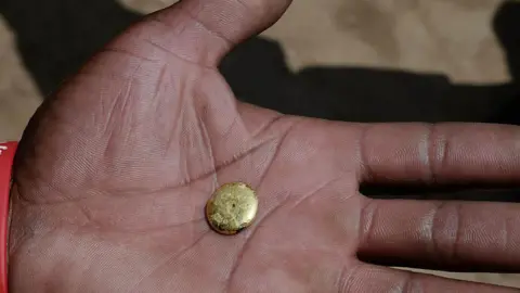 Getty Images A tiny gold ingot sits on the on the palm of a hand in close-up. A wrist band saying "World Aids day" is also visible.