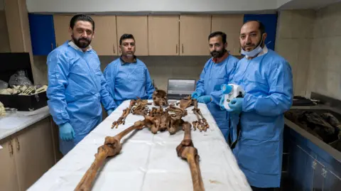 BBC L-R: Dr Taj Eddin Shaker, Dr Anas al-Hourani, Dr Amer Saraqbi and Dr Yasser Al Qassem stand around a skeleton on a table.
