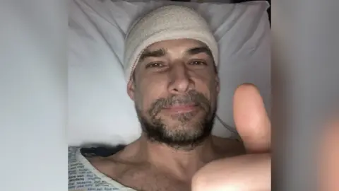 Craig Russell A selfie picture of Craig with a beard and moustache, lying in a hospital bed wearing a hospital gown. His head is bandaged up and he is doing a thumbs up and smiling at the camera.
