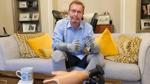 Michael Keohan/BBC Lord Craig Mackinlay sits on a grey sofa. He is a middle aged man wearing glasses and has four prothestic limbs.

