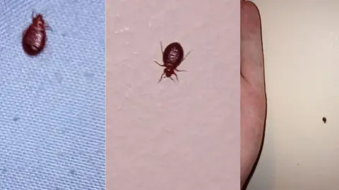 Contributor A composite image made up of three images. They each are pictures of a bedbug, which is about 1-2cm large and brown in colour. 