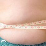 More children are obese than underweight, Unicef warns