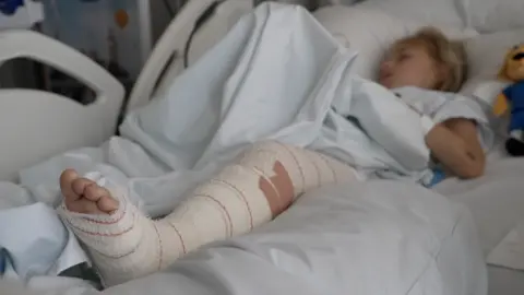 BBC Frida's leg is shown close-up, with bandage and tape. Frida can be seen sleeping in the background
