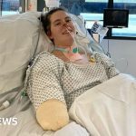 Sepsis leaves Cardiff medical student facing life with no limbs